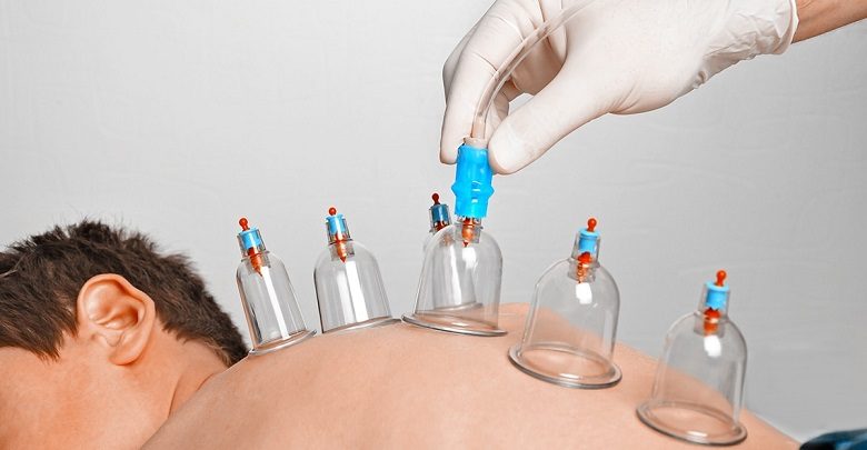 دستگاه بادکش برقی